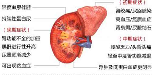 【痛风诊疗一本通】第十三课：痛风可根据严重程度分为哪几个阶段？